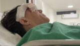 Após cirurgia, mulher que foi atacada por um pitbull, na orla de Petrolina, recebe alta