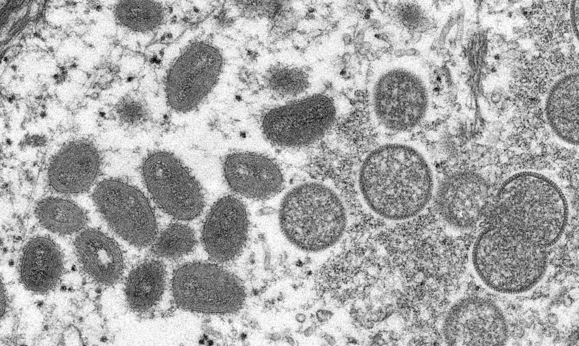 "É cedo para fazermos afirmações sobre letalidade", diz médica sobre varíola dos macacos