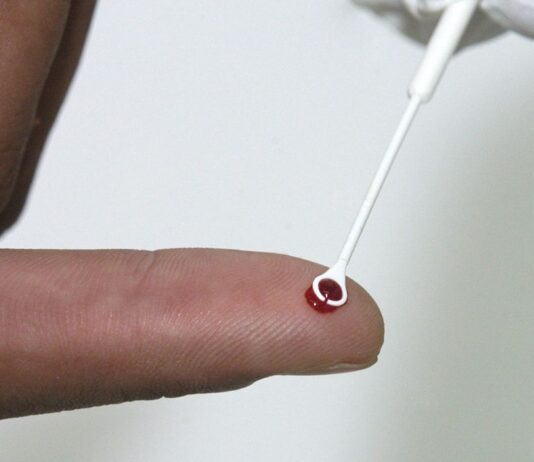 Sesab nega surto de HIV/Aids na Bahia entre jovens