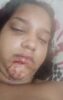 “Me deu um murro na boca”: Jovem acusa motorista do SAMU de Juazeiro de agressão; Sesau dá outra versão para o caso