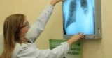Bolsa Família reduziu casos de tuberculose em 60% e mortalidade em 70% em 11 anos