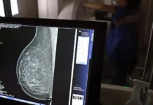 Governo Federal sanciona lei que amplia acesso das mulheres ao exame de mamografia fornecido pelo SUS