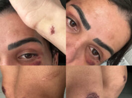 Modelo trans é brutalmente agredida na Ilha do Fogo após reclamar de filmagens; OSC Cores denuncia caso