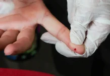 SUS passa a oferecer teste rápido de dengue