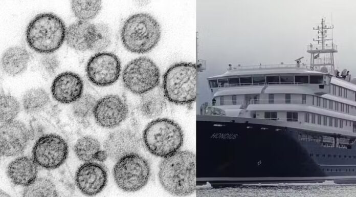Caso de hantavírus é confirmado em novo país; surto ligado a cruzeiro chega a 12 infecções