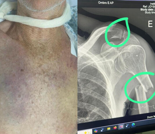 Idoso de 78 anos é hospitalizado após ser agredido em disputa por herança em fazenda na zona rural de Juazeiro, denuncia familiar da vítima