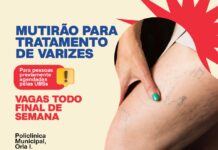 Mutirão de Tratamento de Varizes ultrapassa 4 mil atendimentos e segue com ações aos finais de semana em Juazeiro