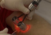 Prefeitura de Casa Nova amplia oferta de serviços de saúde e atende mais de 130 mulheres com escleroterapia