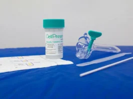 SUS detecta quase 10 mil testes positivos para HPV de alto risco